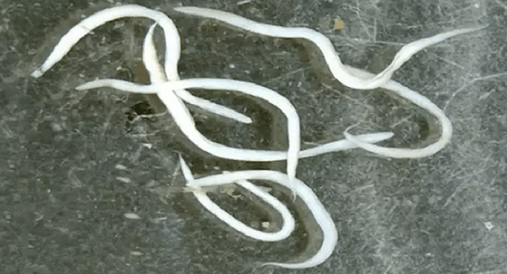 oxiuros en el cuerpo humano