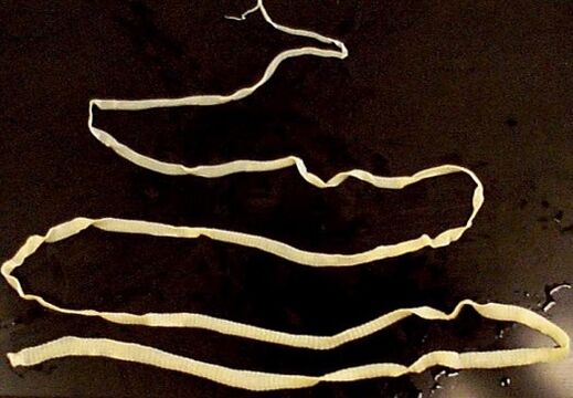tenia ancha del cuerpo humano