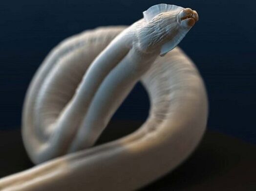 toxocara del cuerpo humano