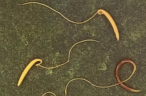 tricocéfalo del cuerpo humano