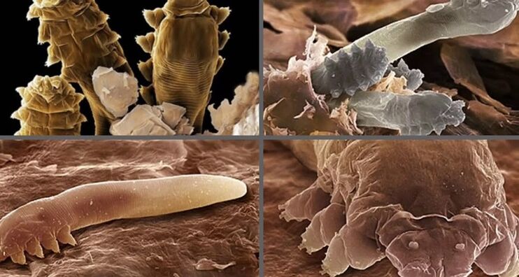 tipos de parásitos cutáneos humanos