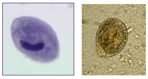 Balantidia ciliados, parásitos del intestino grueso