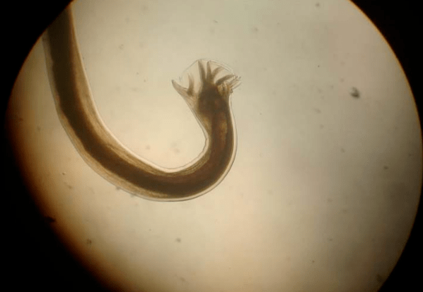 Parásito bajo un microscopio
